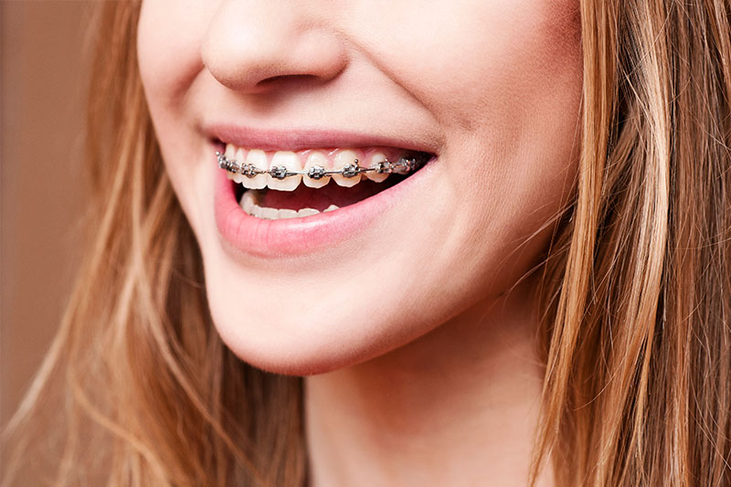 Orthodontics in Oradell